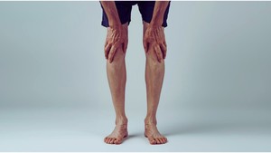 [건강 365] 48. 골다공증